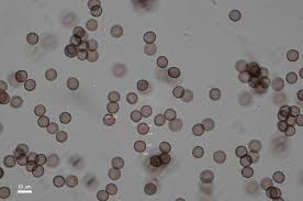 Attēlu rezultāti vaicājumam “Physarum oblatum spores”