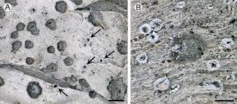 Attēlu rezultāti vaicājumam “Arthonia byssacea”