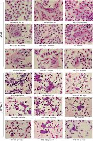 Attēlu rezultāti vaicājumam “Pseudobryum cinclidioides cells”