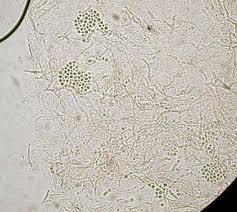 Attēlu rezultāti vaicājumam “Badhamia versicolor spores”