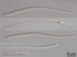 Attēlu rezultāti vaicājumam “Mycosphaerella millegrana”