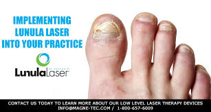 Image result for lunula nail