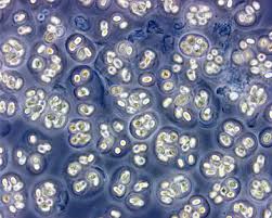 Attēlu rezultāti vaicājumam “Gloeocapsa rupestris”