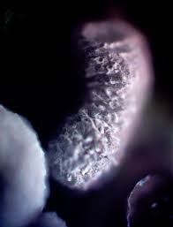 Attēlu rezultāti vaicājumam “Badhamiopsis sp.”