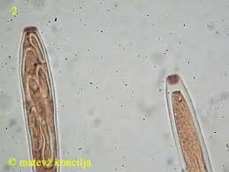 Attēlu rezultāti vaicājumam “Lachnellula willkommii”