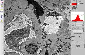 Image result for Deben Sc