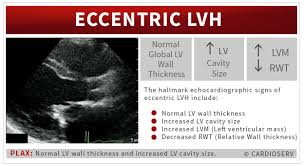 Image result for  ^ L V [ h    