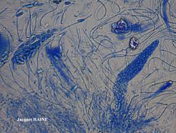 Attēlu rezultāti vaicājumam “Thelopsis rubella”