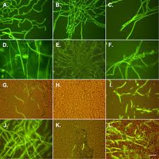 Attēlu rezultāti vaicājumam “Collaria rubens spores”