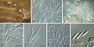 Attēlu rezultāti vaicājumam “Ombrophila violacea spores”