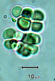 Attēlu rezultāti vaicājumam “Gloeocapsa rupestris”