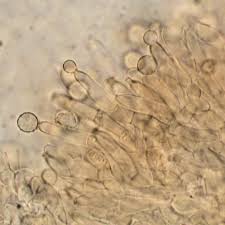 Attēlu rezultāti vaicājumam “Hypocreopsis lichenoides”