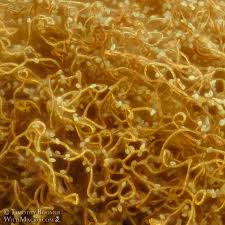 Attēlu rezultāti vaicājumam “Heterotrichia pomiformis (syn. Arcyria pomiformis)”