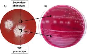 Attēlu rezultāti vaicājumam “Enteridium variabile spores”