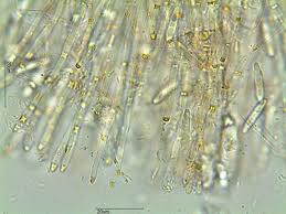 Attēlu rezultāti vaicājumam “Mitrula paludosa”