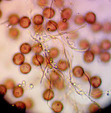 Attēlu rezultāti vaicājumam “Diderma testaceum sessile”