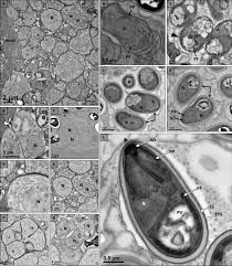 Attēlu rezultāti vaicājumam “Badhamia affinis var. microspora macro”