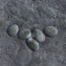 Attēlu rezultāti vaicājumam “Lecanora albella”