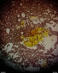 Attēlu rezultāti vaicājumam “Physarum alexandrowiczii”