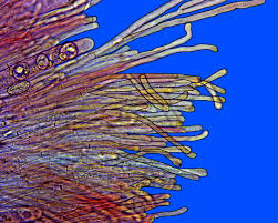 Attēlu rezultāti vaicājumam “Sowerbyella radiculata”