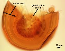 Attēlu rezultāti vaicājumam “Reticularia jurana spores”