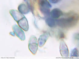 Attēlu rezultāti vaicājumam “Calicium adspersum”