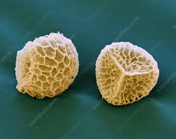 Attēlu rezultāti vaicājumam “Lignydium muscorum spores”