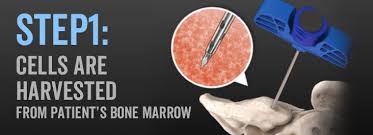 Image result for BMAC