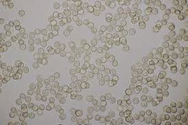 Attēlu rezultāti vaicājumam “Lycogala melleum”