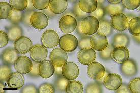 Attēlu rezultāti vaicājumam “Perichaena corticalis macro”