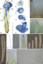 Attēlu rezultāti vaicājumam “Orthotrichum diaphanum sporophyte”