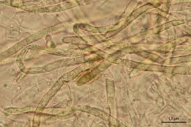 Attēlu rezultāti vaicājumam “Hydnocristella himantia”