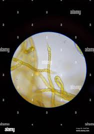 Attēlu rezultāti vaicājumam “Oligonema favogineum”