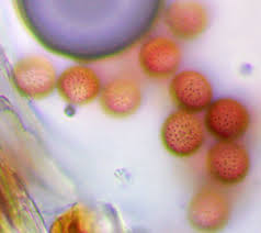 Attēlu rezultāti vaicājumam “Comatricha elegans var. microspora”