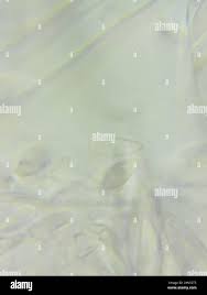 Attēlu rezultāti vaicājumam “Cudoniella acicularis”