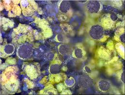 Attēlu rezultāti vaicājumam “Chaenotheca chrysocephala”