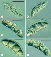 Attēlu rezultāti vaicājumam “Stemonitopsis aequalis var. microspora spores”