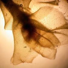 Attēlu rezultāti vaicājumam “Leiocolea rutheana”