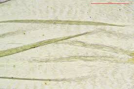 Attēlu rezultāti vaicājumam “Rhytidiadelphus subpinnatus”