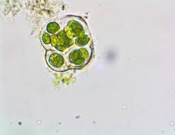 Attēlu rezultāti vaicājumam “Gloeocapsa rupestris”