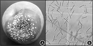 Attēlu rezultāti vaicājumam “Nectria sp., Neonectria sp.”