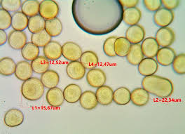 Attēlu rezultāti vaicājumam “Hemitrichia karstenii”