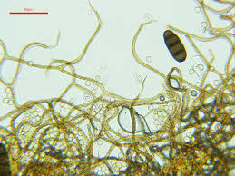 Attēlu rezultāti vaicājumam “Hemitrichia leiotricha stalked”