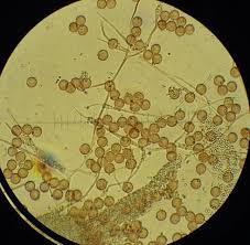 Attēlu rezultāti vaicājumam “Fuligo septica cf. rufa”