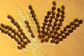 Attēlu rezultāti vaicājumam “Sordaria fimicola”