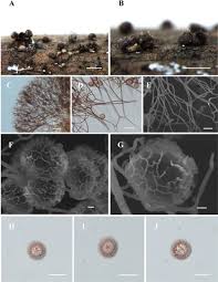 Attēlu rezultāti vaicājumam “Diachea muscorum spores”