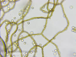Attēlu rezultāti vaicājumam “Arcyria minuta spores”