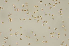 Attēlu rezultāti vaicājumam “Lichenomphalia umbellifera”