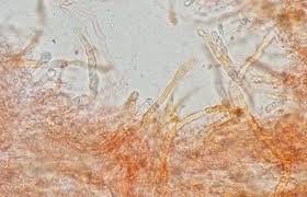 Attēlu rezultāti vaicājumam “Vuilleminia comedens”