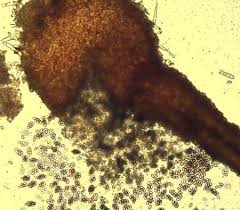 Attēlu rezultāti vaicājumam “Ophiostoma polyporicola”